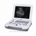 DW-500 diagnostic ultrasound equipment laptop ultrasound scanner